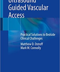 Ultrasound Guided Vascular Access: Practical Solutions to Bedside Clinical Challenges 1st ed. 2022 Edition PDF