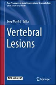 Vertebral Lesions (New Procedures in Spinal Interventional Neuroradiology) 1st ed. 2017