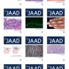 Journal of the American Academy of Dermatology 2021 Full Archives (PDF)