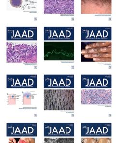 Journal of the American Academy of Dermatology 2021 Full Archives (PDF)