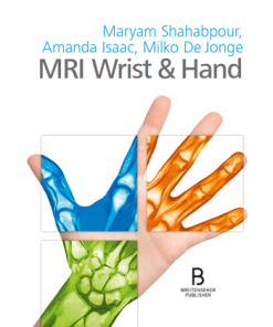 MRI Wrist & Hand (PDF)