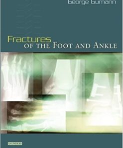 Fractures of the Foot and Ankle (PDF)