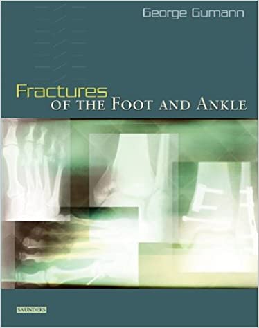 Fractures of the Foot and Ankle (PDF) Fractures of the Foot and Ankle (PDF)
