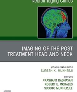 Imaging of the Post Treatment Head and Neck, An Issue of Neuroimaging Clinics of North America, E-Book (Clinics Collections) (PDF)