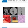 Journal of Neurosurgery 2023 Full Archives (PDF)