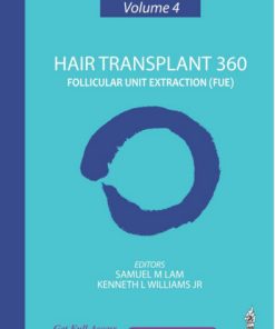 Hair Transplant 360: Follicular Unit Extraction – Volume 4