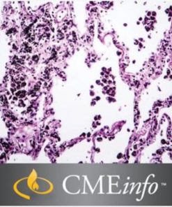 Lung Pathology Masters of Pathology Series