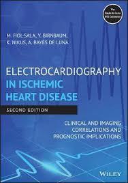 Electrocardiography in Ischemic Heart Disease: Clinical and Imaging Correlations and Prognostic Implications