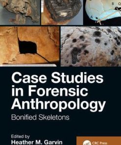 Case Studies in Forensic Anthropology: Bonified Skeletons 1st Edition