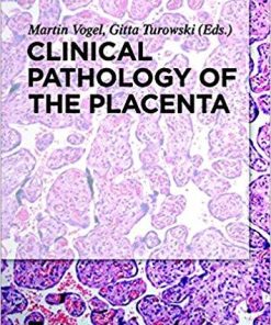 Clinical Pathology of the Placenta 1st Edition