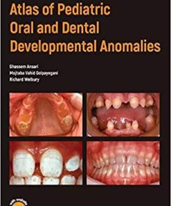 Atlas of Pediatric Oral and Dental Developmental Anomalies 1st Edition