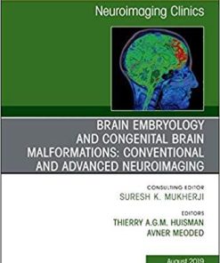 Brain Embryology and the Cause of Congenital Malformations, An Issue of Neuroimaging Clinics of North America (The Clinics: Radiology) 1st Edition