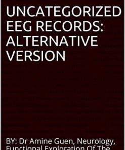 UNCATEGORIZED EEG RECORDS: ALTERNATIVE VERSION: BY: Dr Amine Guen, Neurology, Functional Exploration Of The Nervous System