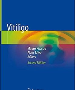 Vitiligo 2nd ed. 2019 Edition