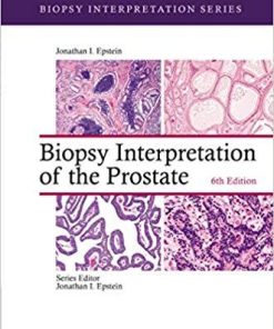 Biopsy Interpretation of the Prostate (Biopsy Interpretation Series) Sixth Edition