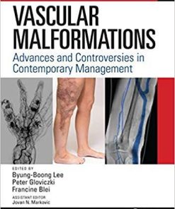 Vascular Malformations: Advances and Controversies in Contemporary Management 1st Edition