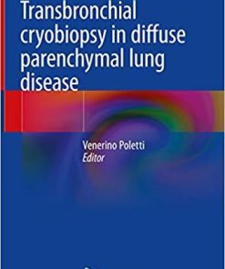 Transbronchial cryobiopsy in diffuse parenchymal lung disease 1st ed. 2019 Edition