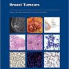 WHO Classification of Tumours-Breast Tumours 5th