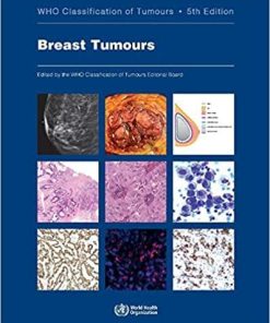 WHO Classification of Tumours-Breast Tumours 5th