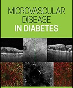 Microvascular Disease in Diabetes 1st Edition