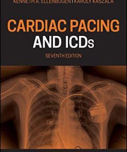 Cardiac Pacing and ICDs Kindle Edition