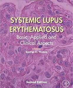 Systemic Lupus Erythematosus: Basic, Applied and Clinical Aspects 2nd Edition