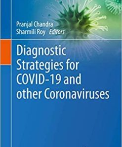 Diagnostic Strategies for COVID-19 and other Coronaviruses (Medical Virology: From Pathogenesis to Disease Control) 1st ed. 2020 Edition