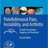 Patellofemoral Pain, Instability, and Arthritis: Clinical Presentation, Imaging, and Treatment 2nd ed. 2020 Edition