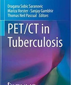 PET/CT in Tuberculosis (Clinicians’ Guides to Radionuclide Hybrid Imaging) 1st ed. 2020 Edition