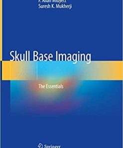 Skull Base Imaging: The Essentials 1st ed. 2020 Edition