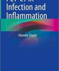 PET-CT in Infection and Inflammation 1st ed. 2021 Edition