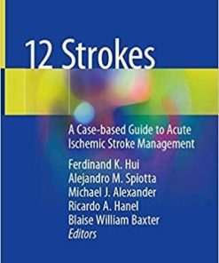 12 Strokes: A Case-based Guide to Acute Ischemic Stroke Management 1st ed. 2021 Edition