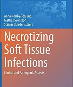 Necrotizing Soft Tissue Infections: Clinical and Pathogenic Aspects (Advances in Experimental Medicine and Biology, 1294) 1st ed. 2020 Edition