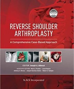 Reverse Shoulder Arthroplasty: A Comprehensive Case-Based Approach 1st Edition