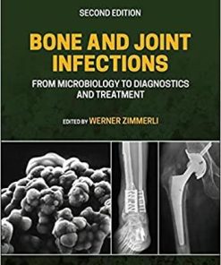 Bone and Joint Infections: From Microbiology to Diagnostics and Treatment 2nd Edition