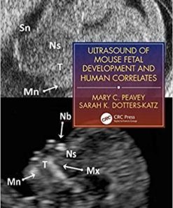 Ultrasound of Mouse Fetal Development and Human Correlates (Reproductive Medicine and Assisted Reproductive Techniques Series) 1st Edition