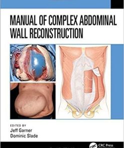 Manual of Complex Abdominal Wall Reconstruction 1st Edition