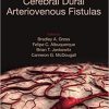 Cerebral Dural Arteriovenous Fistulas 1st Edition