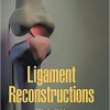 Ligament Reconstructions (World Scientific Series: From Biomaterials Towards Medical D)