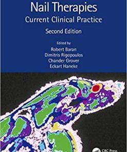 Nail Therapies: Current Clinical Practice 2nd Edition