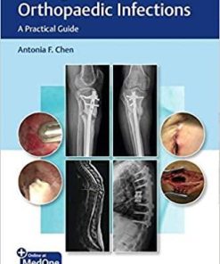 Management of Orthopaedic Infections: A Practical Guide 1st Edition