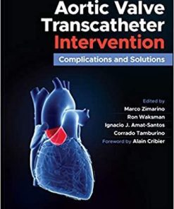 Aortic Valve Transcatheter Intervention: Complications and Solutions 1st Edition