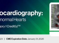 2023 Fetal Echocardiography: Normal and Abnormal Hearts – A Video CME Teaching Activity