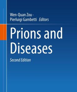 Prions and Diseases, 2nd Edition (EPUB)