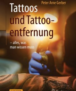 Tattoos und Tattooentfernung (EPUB)