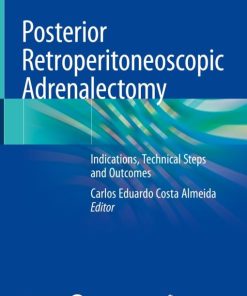 Posterior Retroperitoneoscopic Adrenalectomy (EPUB)