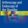 Arthroscopy and Endoscopy of the Shoulder (PDF)