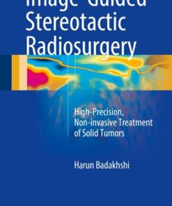 Image-Guided Stereotactic Radiosurgery: High-Precision, Non-invasive Treatment of Solid Tumors (EPUB)