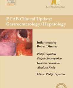 Inflammatory Bowel Diseases – ECAB (PDF)