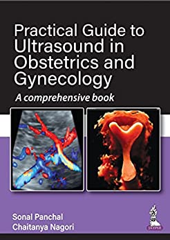 Practical Guide to Ultrasound in Obstetrics and Gynecology: A comprehensive book (PDF)